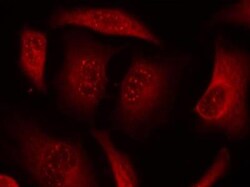 FOXO3, p Ser253 Antibody, Novus Biologicals 0.025 mL; Unconjugated:Antibodies,